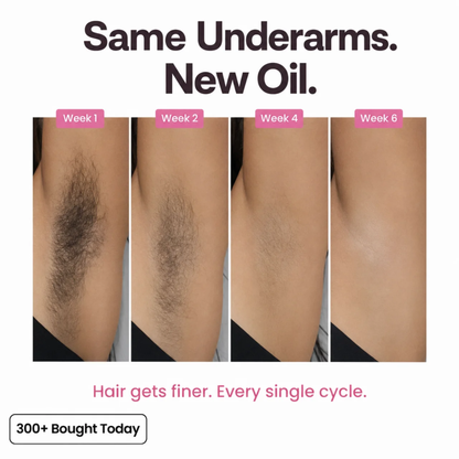 Insideefy-Hair Reduction Oil